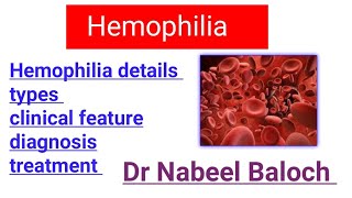 Hemophilia details lectures  Hematology [upl. by Hodgkinson]