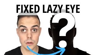 Lazy Eye Fixed amblyopia strabismus [upl. by Adnuhser]