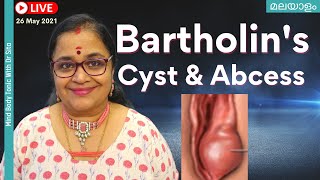 Bartholin Cyst  മലയാളം  Abscess  Symptoms amp Treatment  Marsupalisation   Dr Sita [upl. by Armstrong]