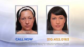 NonSurgical Facelift [upl. by Noguchi]