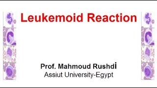 Leukemoid Reaction Arabic 2017 [upl. by Yedok]