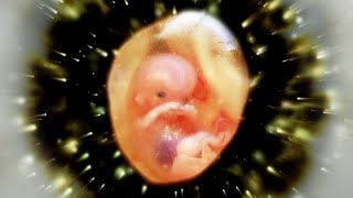 Foetus and Womb Protection Baby Healing Frequency [upl. by Seyer]