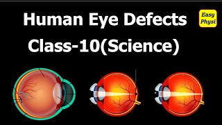 Human Eye Defects Class 10  Class 12 [upl. by Filbert]