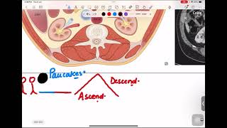 GITRetroperitoneal Organs [upl. by Darrow]