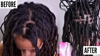 ALL About INTERLOCKING Locs  Does It Cause THINNING  Dreadlock QampA [upl. by Hcirteid]