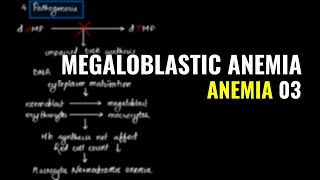 Megaloblastic Anemia  Schilling Test  Anemia 03  Pathology MBBS IOM [upl. by Harrak]