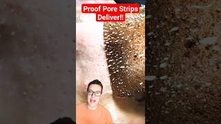 PROOF PORE STRIPS WORK  Phenomenal Pore Strip Removal shorts [upl. by Akimal]