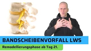 Bandscheibenvorfall LWS  Heilungsphasen Teil 3 von 3 [upl. by Adnohsek576]