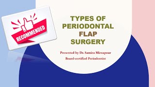 Periodontal Flap Surgery for Periodontitis [upl. by Danelle183]