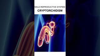 MALE REPRODUCTIVE SYSTEMCRYPTORCHIDISM [upl. by Afnin]