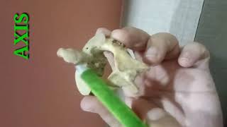 CERVICAL VERTEBRAE PART2  ATYPICAL CERVICAL VERTEBRAE  BY DR MITESH DAVE [upl. by Antone]