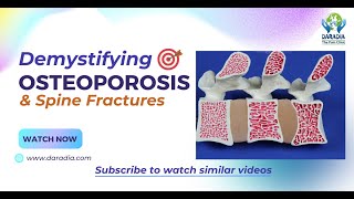 🦴📚Latest Osteoporosis Treatment amp Spine Fractures What a Physician Must Know👨‍⚕️🦴 [upl. by Ecinaej]