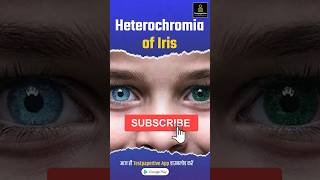 heterochromia of iris  Different Colored Eyes heterochromia eyes ophthalmology testpaperlive [upl. by Eimarej]