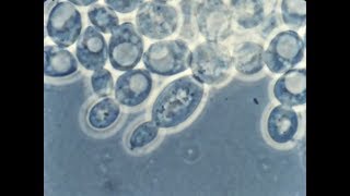 酵母細胞的出芽生殖 Yeast Cells  UMAL57 [upl. by Donaugh901]