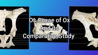 Anatomy of Os Coxae  Part 2  ANATOMY by Dr Payal Jain  NDVSU 1st Year Lecture [upl. by Suhpoelc]