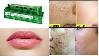 Top 10 Uses amp Benefits of BOROLINEBeauty Hacks using BOROLINE [upl. by Silvia872]