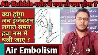 Air Embolism treatment  जब एयर बबल्स हवा नस के अंदर चली जाए तो तब क्या होगा [upl. by Clair]