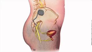 Fecal Incontinence  Heidi Chua MD  Mayo Clinic [upl. by Tessa]