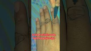 Back side wrinkles genius sign palmistry motivation amazingfacts viralvideo [upl. by Ecinaj]