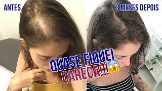 A VERDADE sobre o que aconteceu com o MEU CABELO 😢  Luiza Rossi [upl. by Quackenbush710]