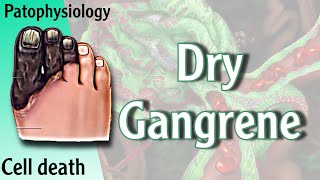 Dry Gangrene Necrosis شرح [upl. by Laehpar935]