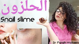 كل ما يجب أن تعرفي قبل شراء الحلزون 🐌 الفرق بين الأنواع السائدة و تاثير ال steroidal snail slime [upl. by Hamnet]