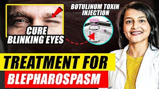 Blepharospasm and Botulinum Toxin Injections  Botulinum Toxin Mechanism of Action  Dr Rwituja [upl. by Nya180]