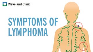 Warning Signs of Lymphoma [upl. by Glen]