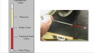 How to Measure the Hematocrit  physio lab practical [upl. by Acsicnarf]