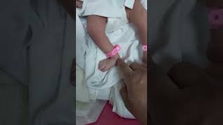 Physical examination foot deformity congenital talipes calcaneovalgus tight muscle positional [upl. by Winni]