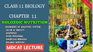 DISORDERS OF DIGESTIVE SYSTEM  CLASS 11 NEW BIOLOGY SINDH BOARD MDCAT  NEW BIOLOGY DOCTORS STOP [upl. by Hildie]