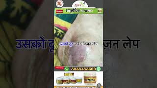 Eczema ayurvedic skin care [upl. by Gnohp]