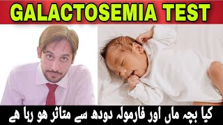 Galactosemia Test  Galactosemia Disease  Galactosemia Kya Hai [upl. by Ecitnirp624]