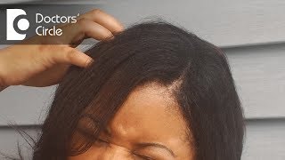 Reasons for itchy scalp and how to treat it  Dr Rasya Dixit [upl. by Portingale312]