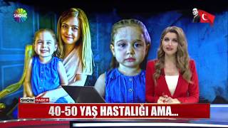 4050 yaş hastalığı ama [upl. by Arrim362]