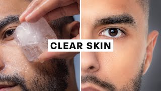 How To Get Clear Skin Science Based [upl. by Winter80]