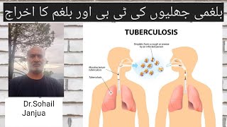 Tuberculosis Homeo treatment DrSohail Janjua [upl. by Borden720]