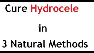 Natural ways to treat Hydrocele [upl. by Fafa]