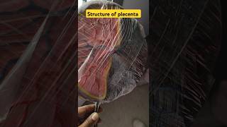 Structure of placenta youtubeshortsshortvideoviralvedio [upl. by Tenrag]