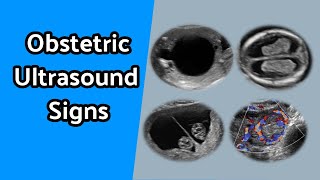 Obstetric Ultrasound Signs [upl. by Cimah]