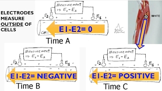 Electromyography EMG Biopac lecture [upl. by Annayad]