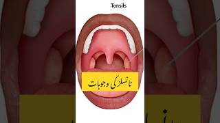 Bacho main tonsil ki wajoohat  heathbenefits tonsilstones tonsillitis tonsils shortsviral [upl. by Annohsak]