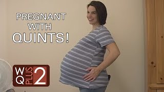 Quintuplet Mom at 33 Weeks and 2 Days [upl. by Jenne]