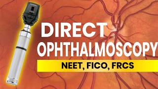 Direct Ophthalmoscopy Tips and Tricks [upl. by Norod564]