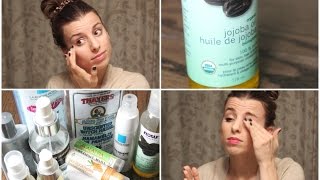 My Skincare Routine  How to Clear your Acne [upl. by Harwin]