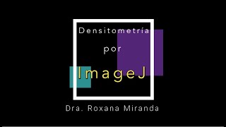 Densitometría por ImageJ [upl. by Fulvia]