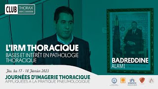 L’IRM thoracique Bases et intérêt en pathologie thoracique [upl. by Tenaj589]