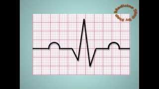 Understanding ECGs  EKG [upl. by Eiramadnil]