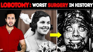 Why is LOBOTOMY The WORST Surgery in History [upl. by Salahi428]