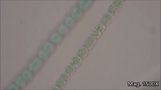 Anabaena under the Microscope [upl. by Eeryk]